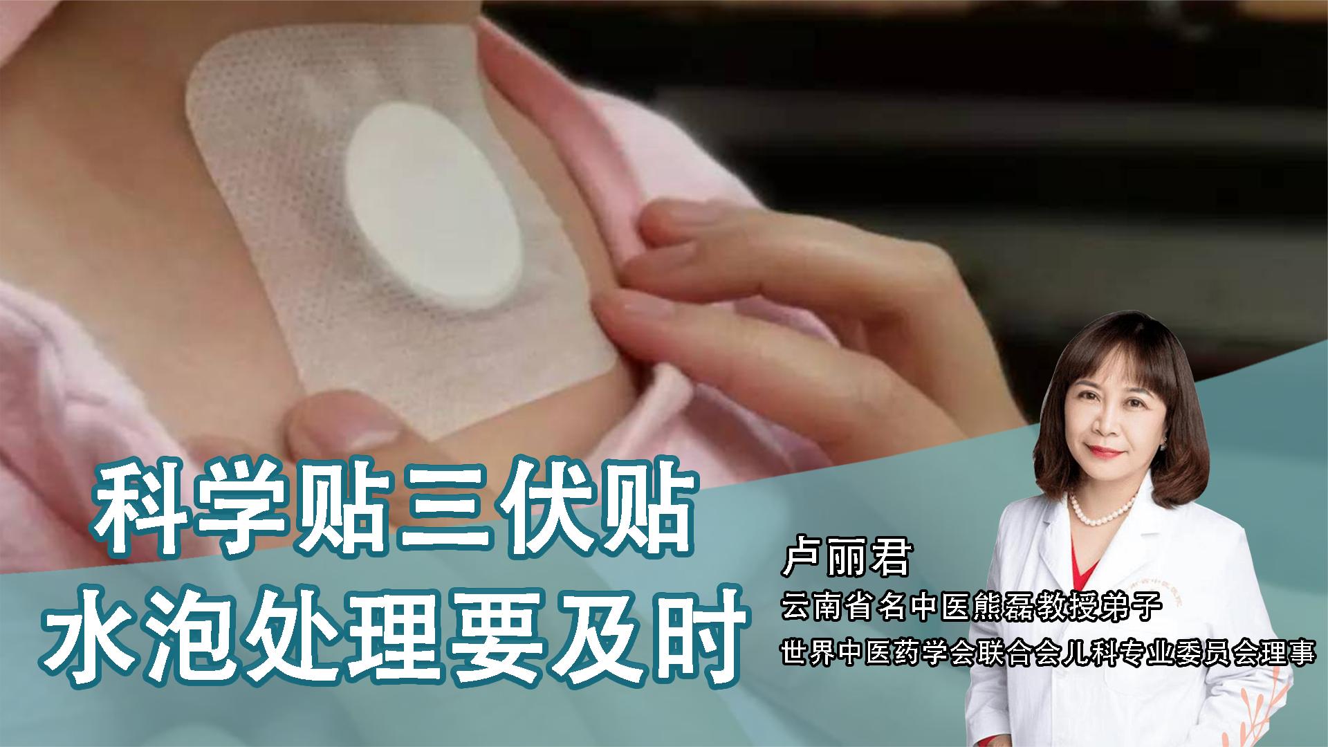 2、貼三伏貼后有什么禁忌？